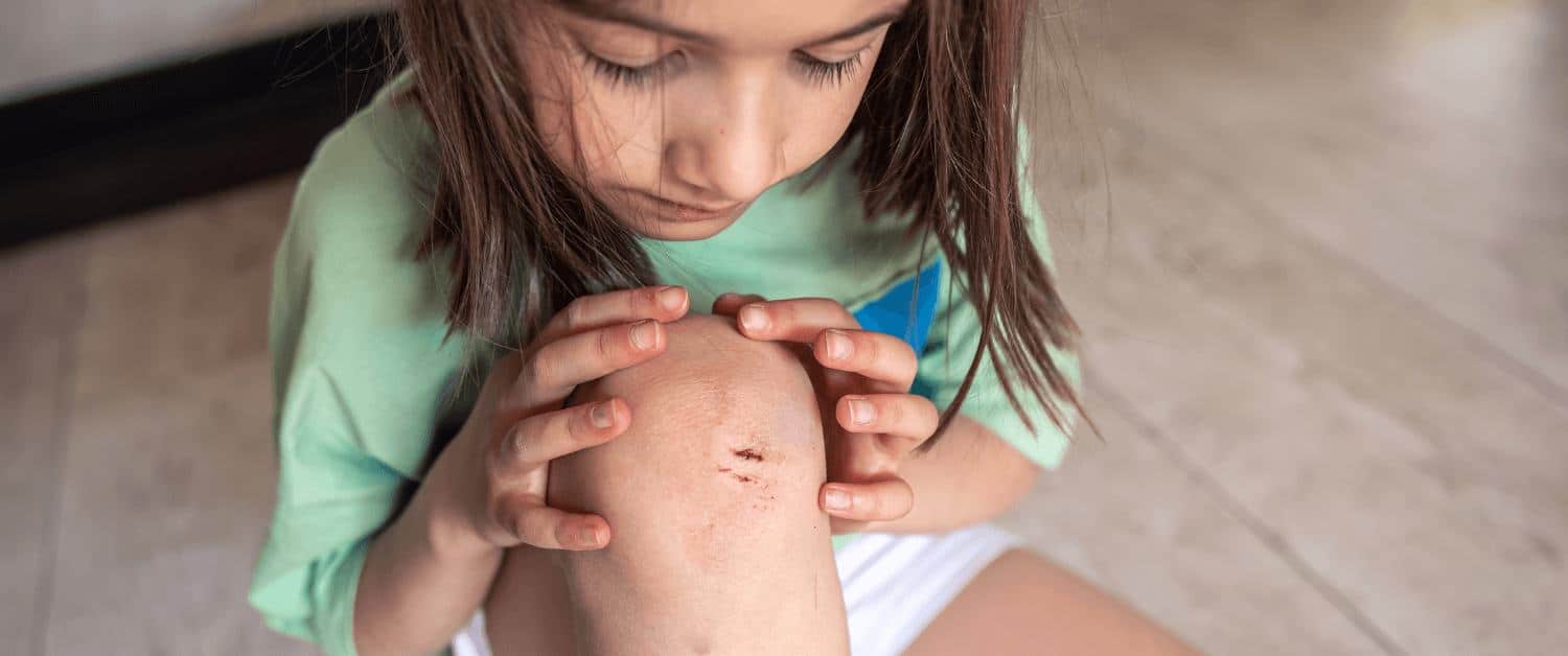 Quick Home remedies for Minor Cuts and burns